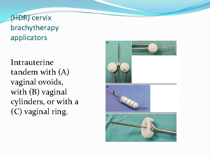 (HDR) cervix brachytherapy applicators Intrauterine tandem with (A) vaginal ovoids, with (B) vaginal cylinders, (HDR) cervix brachytherapy applicators Intrauterine tandem with (A) vaginal ovoids, with (B) vaginal cylinders,