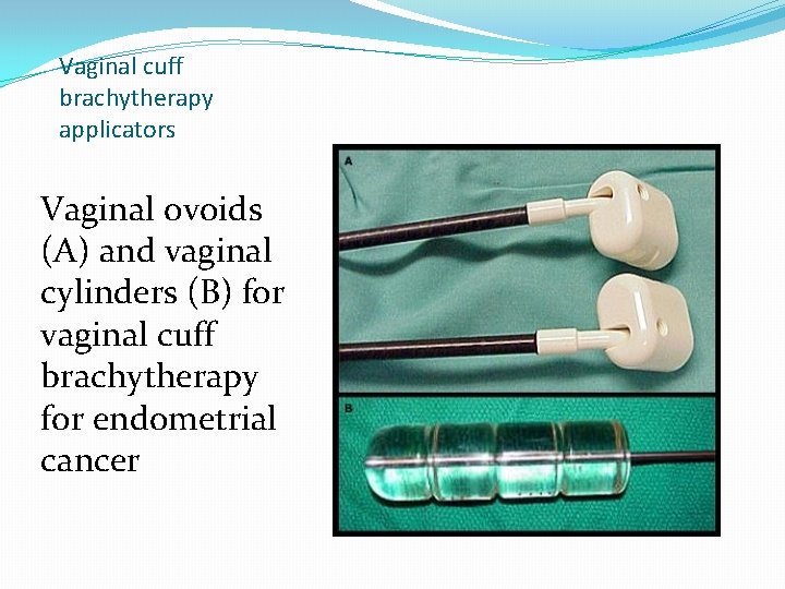 Vaginal cuff brachytherapy applicators Vaginal ovoids (A) and vaginal cylinders (B) for vaginal cuff Vaginal cuff brachytherapy applicators Vaginal ovoids (A) and vaginal cylinders (B) for vaginal cuff