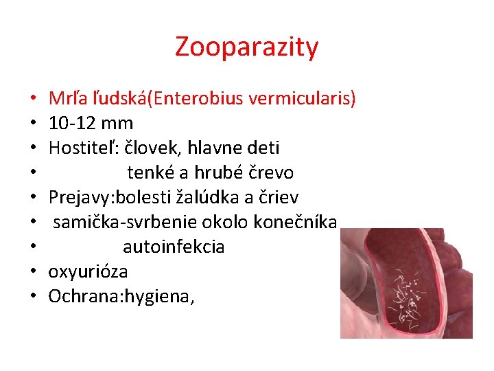 Zooparazity • • • Mrľa ľudská(Enterobius vermicularis) 10 -12 mm Hostiteľ: človek, hlavne deti
