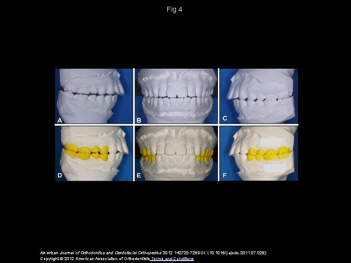Fig 4 American Journal of Orthodontics and Dentofacial Orthopedics 2012 142720 -726 DOI: (10.