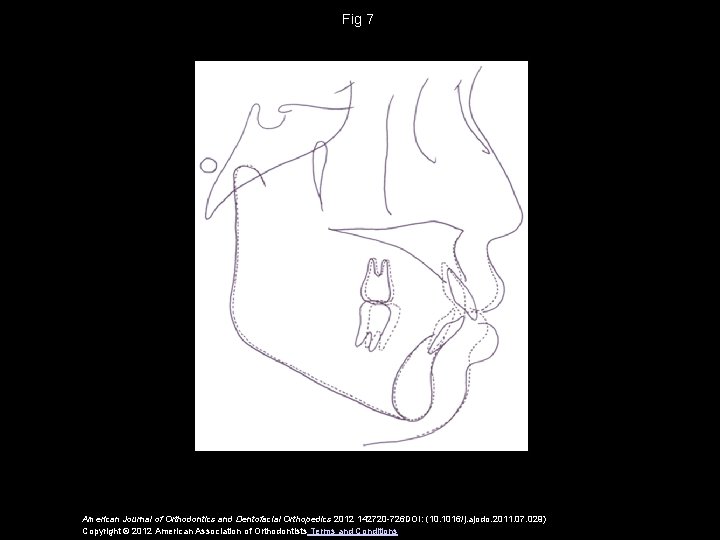 Fig 7 American Journal of Orthodontics and Dentofacial Orthopedics 2012 142720 -726 DOI: (10.