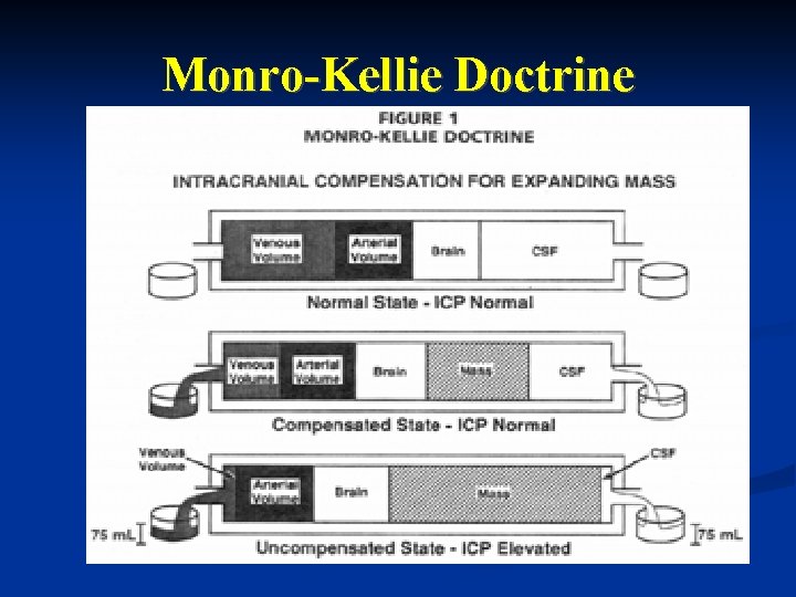 Monro-Kellie Doctrine Monro-Kellie Doctrine
