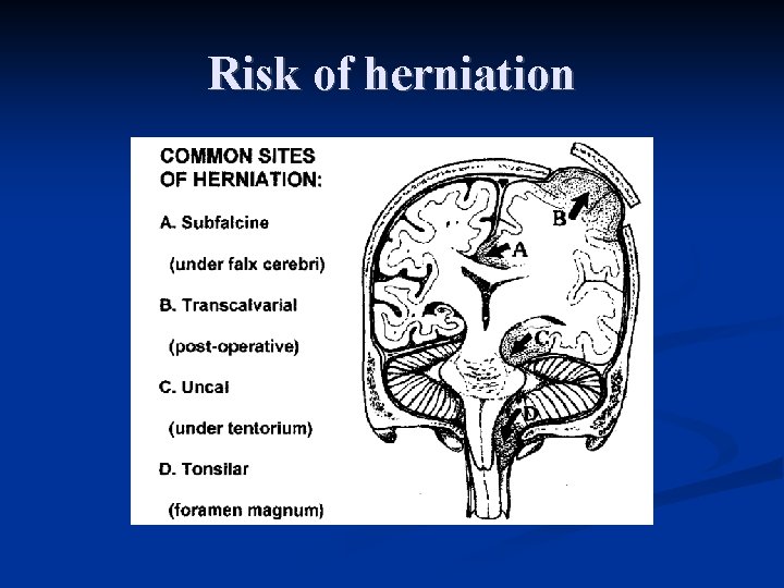 Risk of herniation Risk of herniation