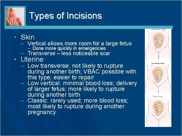 Types of Incisions • Skin – Vertical allows more room for a large fetus