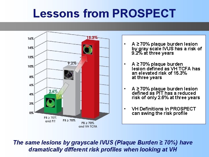 Lessons from PROSPECT • A ≥ 70% plaque burden lesion by gray scale IVUS