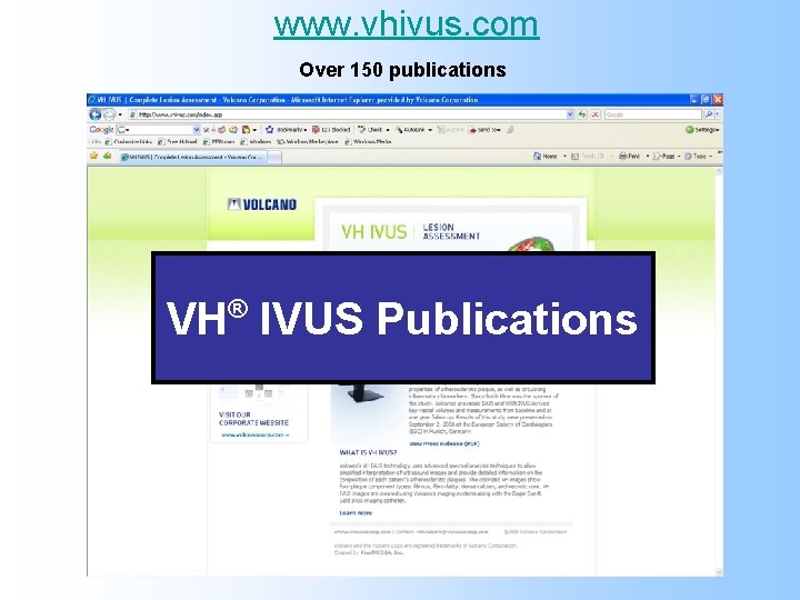 www. vhivus. com Over 150 publications VH IVUS Publications ® 
