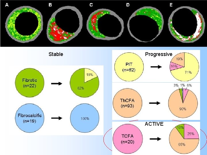 Stable Progressive ACTIVE 