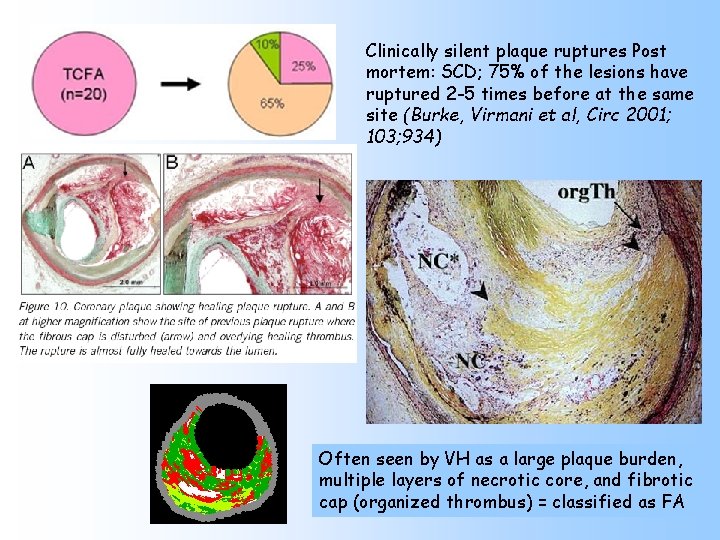 Clinically silent plaque ruptures Post mortem: SCD; 75% of the lesions have ruptured 2