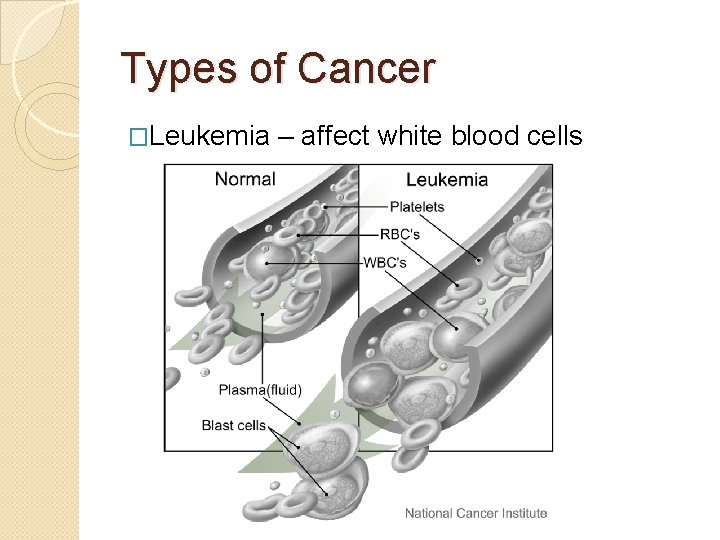 Types of Cancer �Leukemia – affect white blood cells 