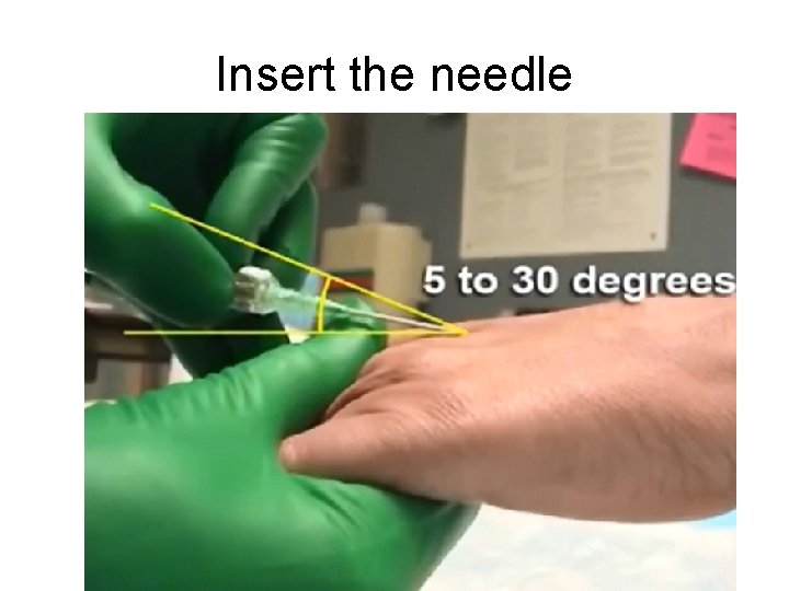 Insert the needle 