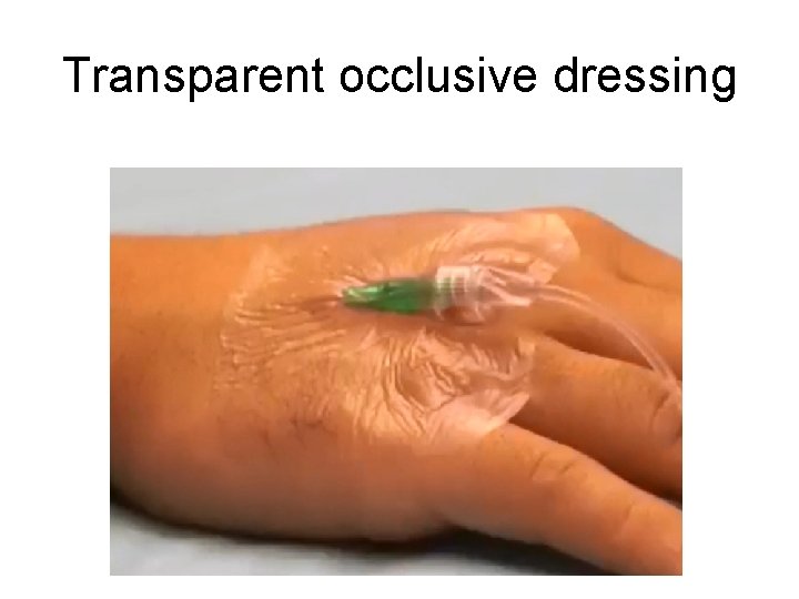 Transparent occlusive dressing 
