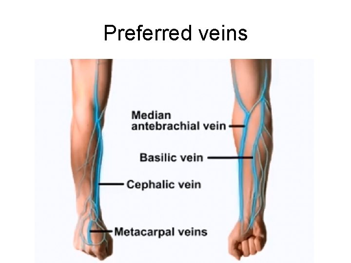 Preferred veins 