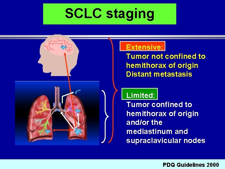 SCLC staging Extensive: Tumor not confined to hemithorax of origin Distant metastasis Limited: Tumor