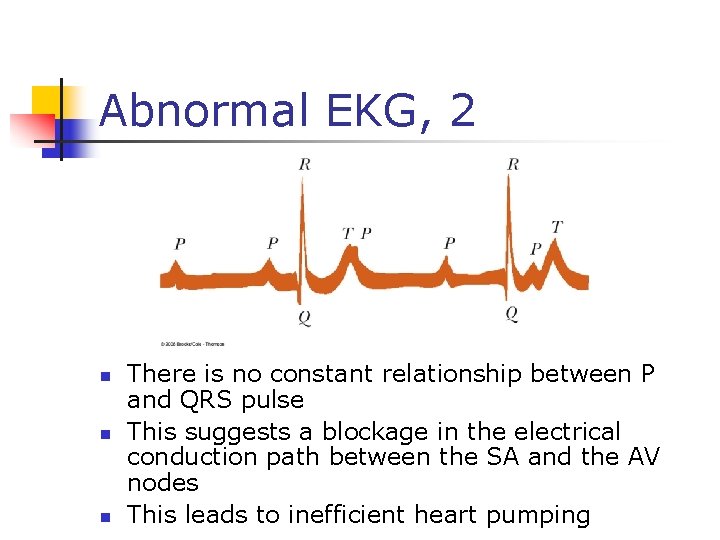 Abnormal EKG, 2 n n n There is no constant relationship between P and