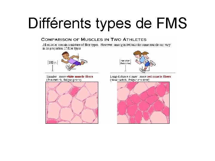 Différents types de FMS 