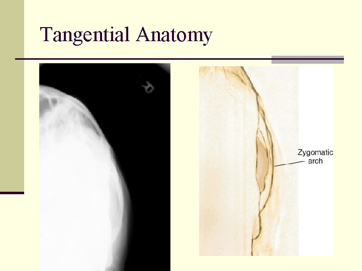 Tangential Anatomy 