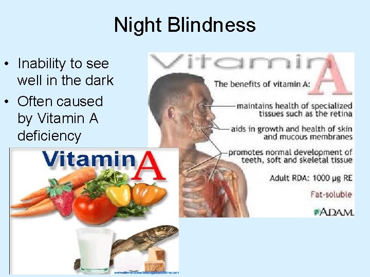 Night Blindness • Inability to see well in the dark • Often caused by