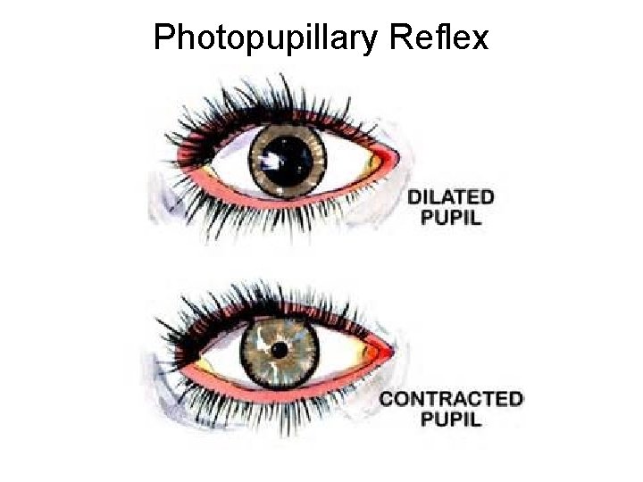 Photopupillary Reflex 