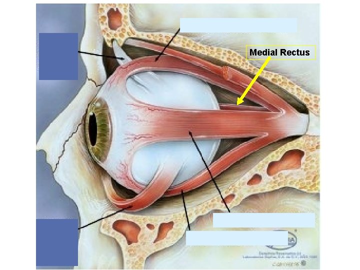 Medial Rectus 