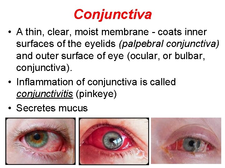 Conjunctiva • A thin, clear, moist membrane - coats inner surfaces of the eyelids