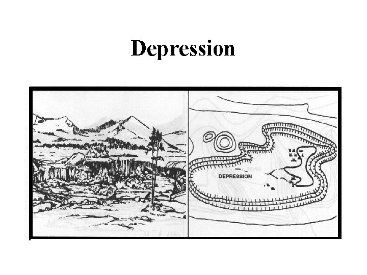 Depression 