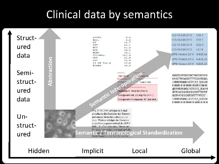 Structured data Semistructured data Abstraction Clinical data by semantics Unstructured Hidden on i t