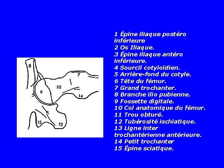 1 Épine iliaque postéro inférieure 2 Os Iliaque. 3 Épine iliaque antéro inférieure. 4 1 Épine iliaque postéro inférieure 2 Os Iliaque. 3 Épine iliaque antéro inférieure. 4