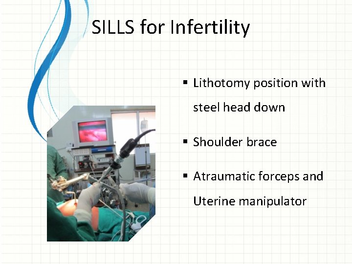 SILLS for Infertility § Lithotomy position with steel head down § Shoulder brace §