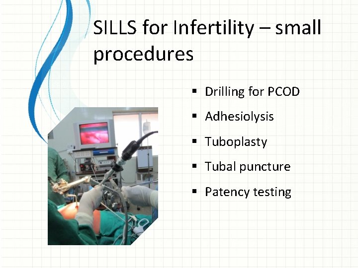 SILLS for Infertility – small procedures § Drilling for PCOD § Adhesiolysis § Tuboplasty