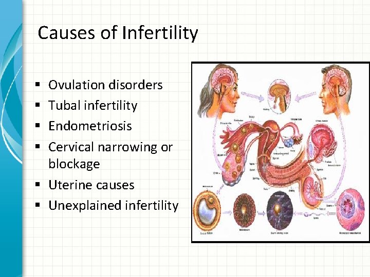 Causes of Infertility Ovulation disorders Tubal infertility Endometriosis Cervical narrowing or blockage § Uterine