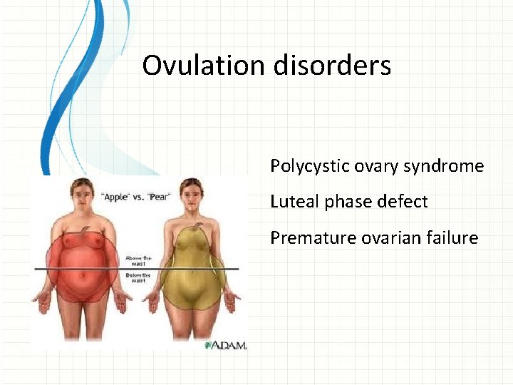 Ovulation disorders Polycystic ovary syndrome Luteal phase defect Premature ovarian failure 