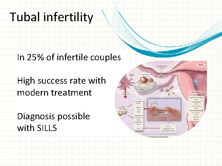 Tubal infertility In 25% of infertile couples High success rate with modern treatment Diagnosis