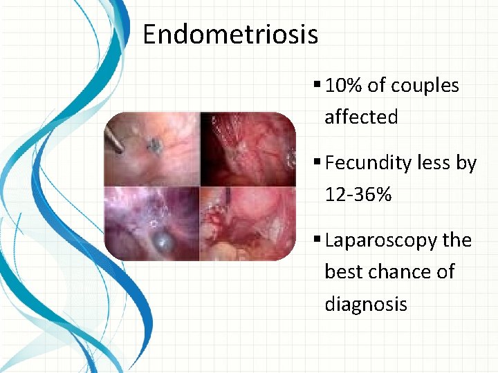 Endometriosis § 10% of couples affected § Fecundity less by 12 -36% § Laparoscopy