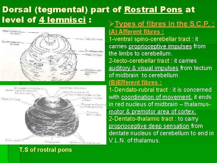 Dorsal (tegmental) part of Rostral Pons at level of 4 lemnisci : ØTypes of