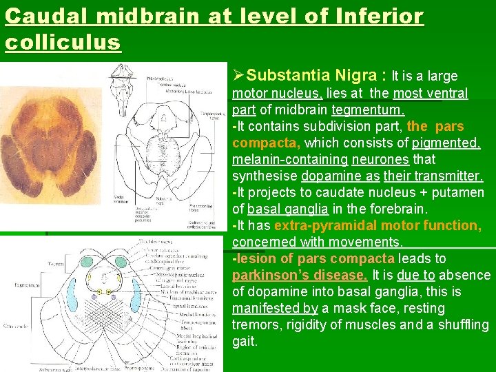 Caudal midbrain at level of Inferior colliculus ØSubstantia Nigra : It is a large