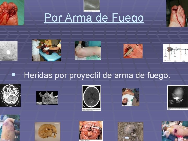 Por Arma de Fuego § Heridas por proyectil de arma de fuego. Por Arma de Fuego § Heridas por proyectil de arma de fuego.