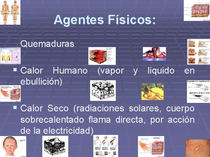 Agentes Físicos: Quemaduras § Calor Humano (vapor y liquido en ebullición) § Calor Seco Agentes Físicos: Quemaduras § Calor Humano (vapor y liquido en ebullición) § Calor Seco