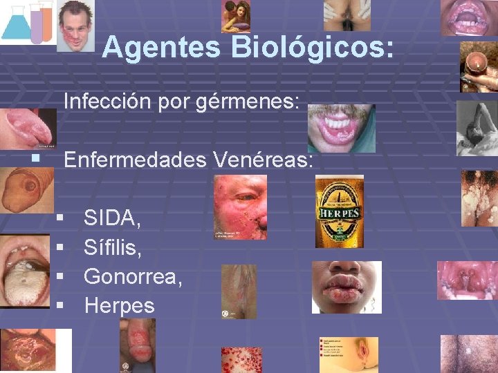 Agentes Biológicos: Infección por gérmenes: § Enfermedades Venéreas: § § SIDA, Sífilis, Gonorrea, Herpes Agentes Biológicos: Infección por gérmenes: § Enfermedades Venéreas: § § SIDA, Sífilis, Gonorrea, Herpes