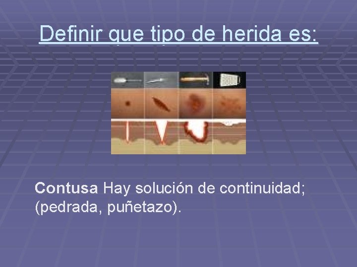 Definir que tipo de herida es: Contusa Hay solución de continuidad; (pedrada, puñetazo). Definir que tipo de herida es: Contusa Hay solución de continuidad; (pedrada, puñetazo).