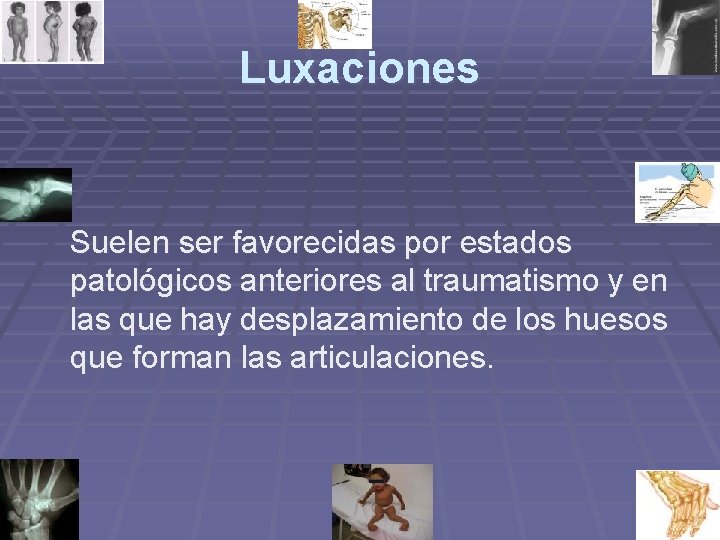 Luxaciones Suelen ser favorecidas por estados patológicos anteriores al traumatismo y en las que Luxaciones Suelen ser favorecidas por estados patológicos anteriores al traumatismo y en las que
