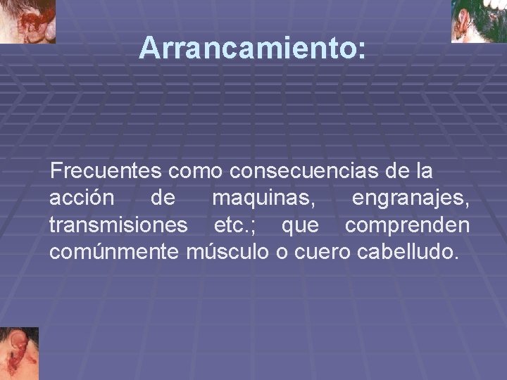 Arrancamiento: Frecuentes como consecuencias de la acción de maquinas, engranajes, transmisiones etc. ; que Arrancamiento: Frecuentes como consecuencias de la acción de maquinas, engranajes, transmisiones etc. ; que
