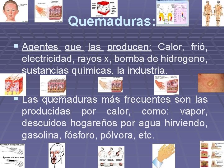 Quemaduras: § Agentes que las producen: Calor, frió, electricidad, rayos x, bomba de hidrogeno, Quemaduras: § Agentes que las producen: Calor, frió, electricidad, rayos x, bomba de hidrogeno,