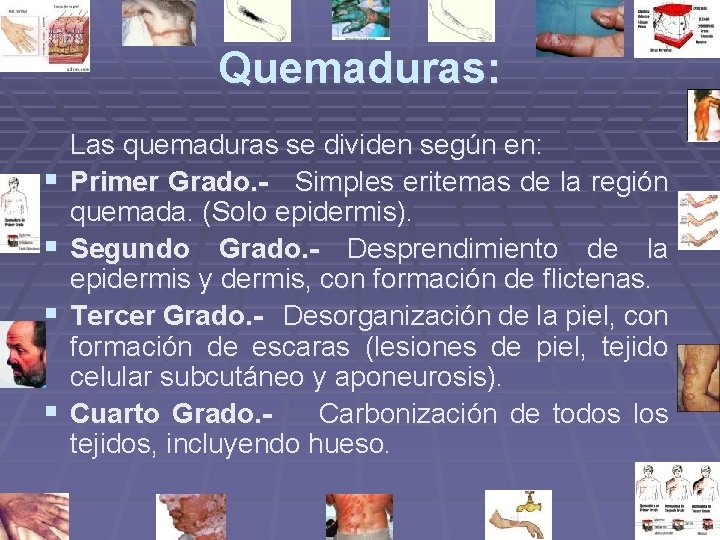 Quemaduras: § § Las quemaduras se dividen según en: Primer Grado. - Simples eritemas Quemaduras: § § Las quemaduras se dividen según en: Primer Grado. - Simples eritemas