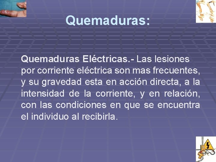 Quemaduras: Quemaduras Eléctricas. - Las lesiones por corriente eléctrica son mas frecuentes, y su Quemaduras: Quemaduras Eléctricas. - Las lesiones por corriente eléctrica son mas frecuentes, y su