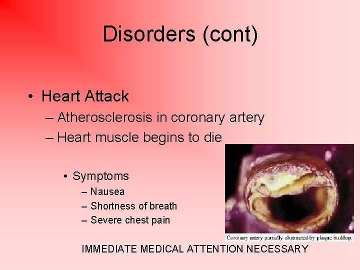 Disorders (cont) • Heart Attack – Atherosclerosis in coronary artery – Heart muscle begins