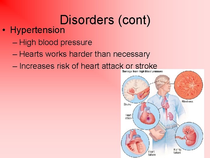 Disorders (cont) • Hypertension – High blood pressure – Hearts works harder than necessary