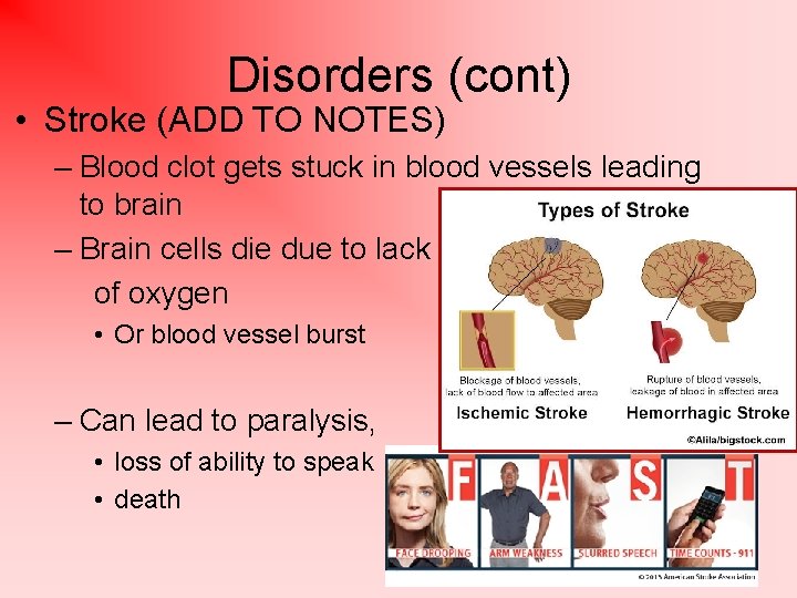 Disorders (cont) • Stroke (ADD TO NOTES) – Blood clot gets stuck in blood