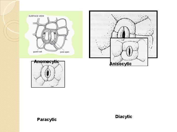 Anomocytic Paracytic Anisocytic Diacytic 