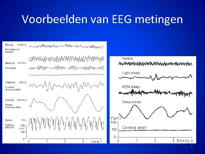 Voorbeelden van EEG metingen 7 
