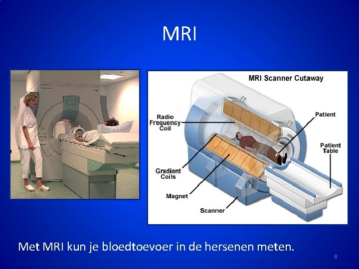 MRI Met MRI kun je bloedtoevoer in de hersenen meten. 8 